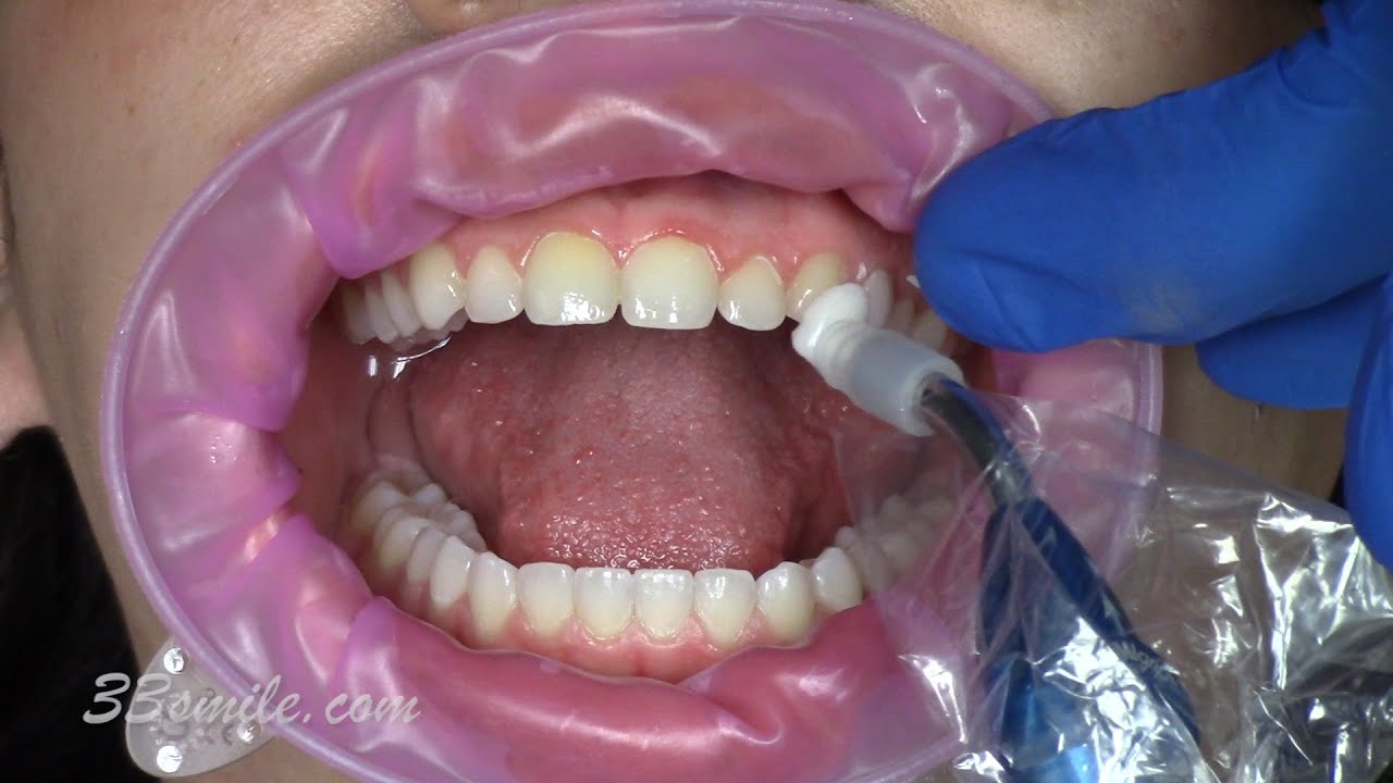 Invisalign & Braces, Cosmetic Dental Associates