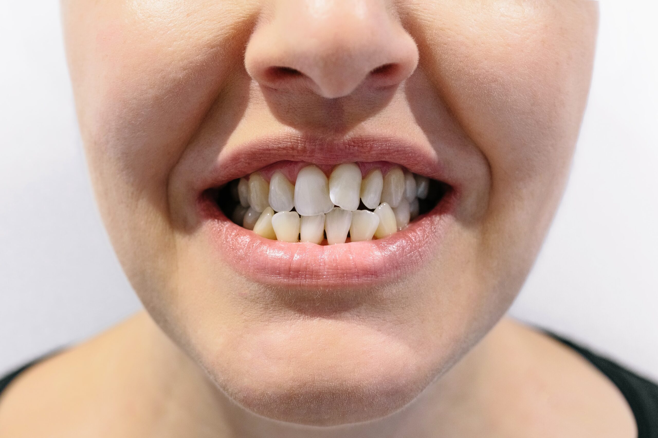 Cosmetic Dental Treatment Virtual Consultation San Antonio